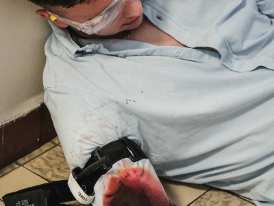 TC aktivní střelec v českobudějovické nemocnici